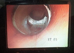 Collapsed Drain in Ashfield                          